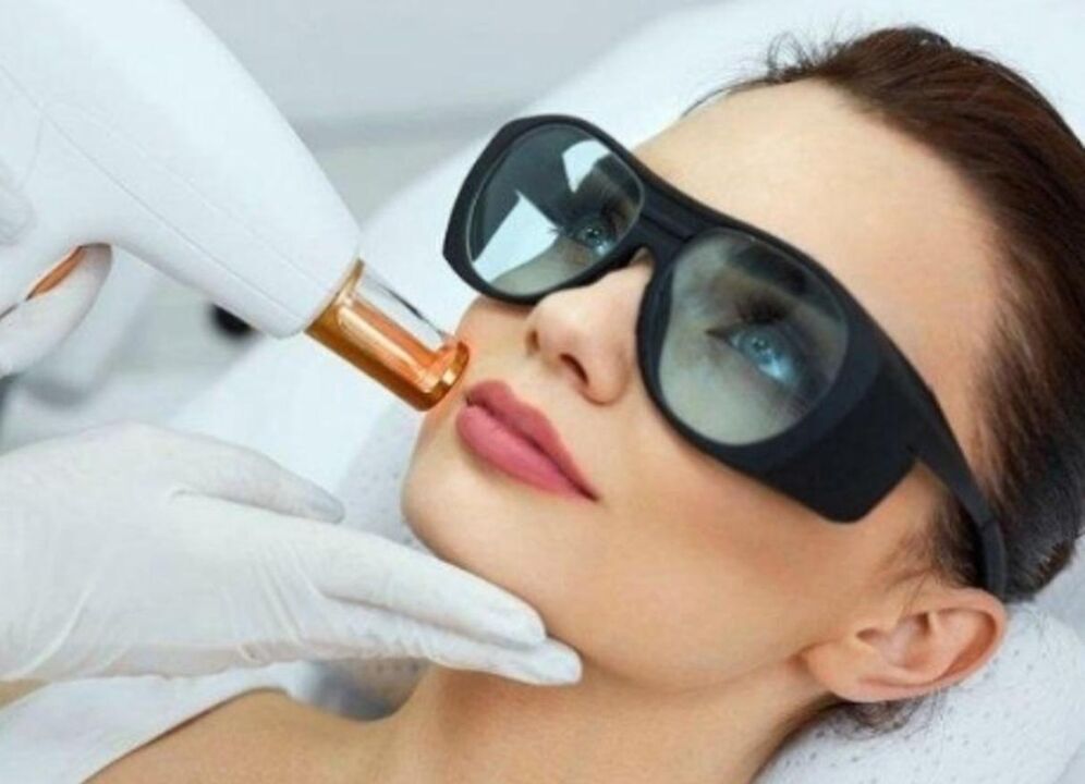 Rejuvenecimiento facial de la piel