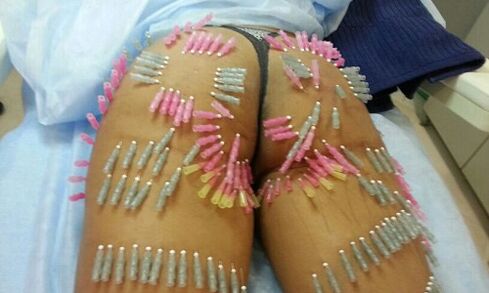 levantamiento de glúteos